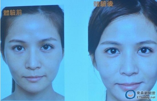 台艺人吴怡霈自曝整容对比照 医生：效果很好