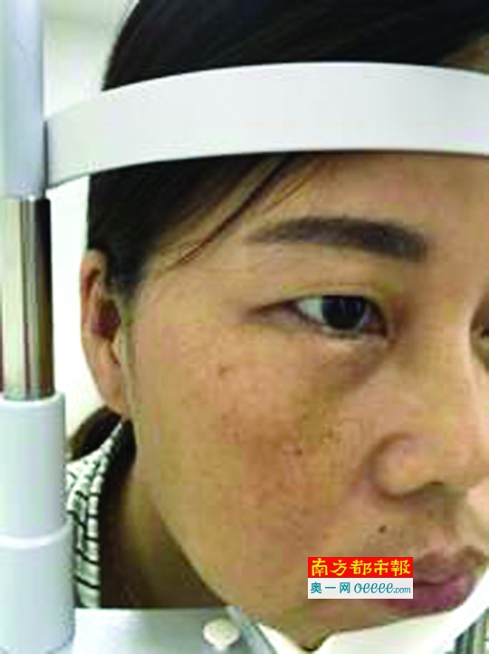在深圳华厦眼科医院感受国际最先进微创无痛玻璃体手术